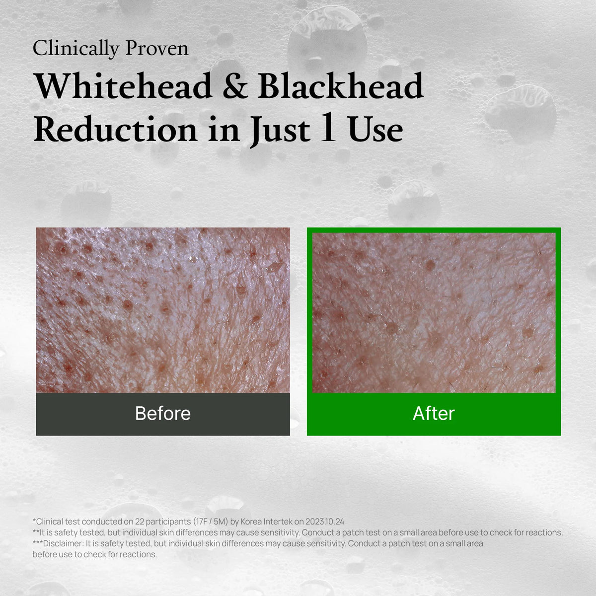 FULLY - Mascarilla y Limpiador de Arcilla Facial Tomate Verde